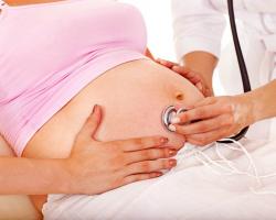 Молочница у женщин: симптомы и лечение заболевания Как протекает молочница
